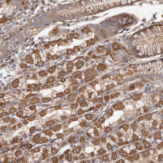 FAM221B Antibody in Immunohistochemistry (Paraffin) (IHC (P))