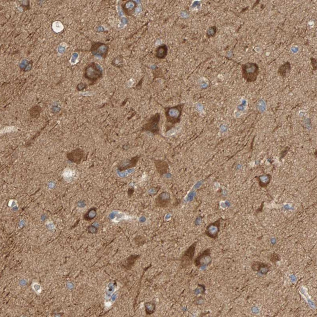 KLHL11 Antibody in Immunohistochemistry (Paraffin) (IHC (P))