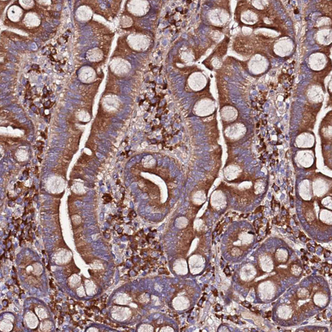 VMO1 Antibody in Immunohistochemistry (Paraffin) (IHC (P))
