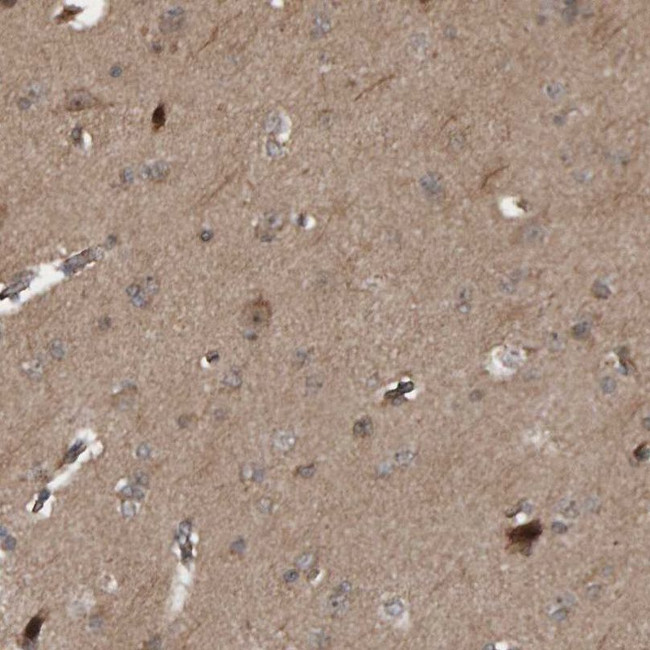 CUEDC1 Antibody in Immunohistochemistry (IHC)