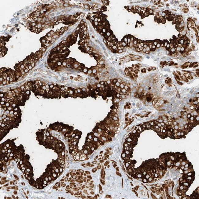 LYRM9 Antibody in Immunohistochemistry (Paraffin) (IHC (P))