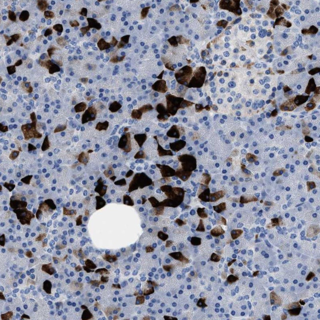 SLN13 Antibody in Immunohistochemistry (Paraffin) (IHC (P))