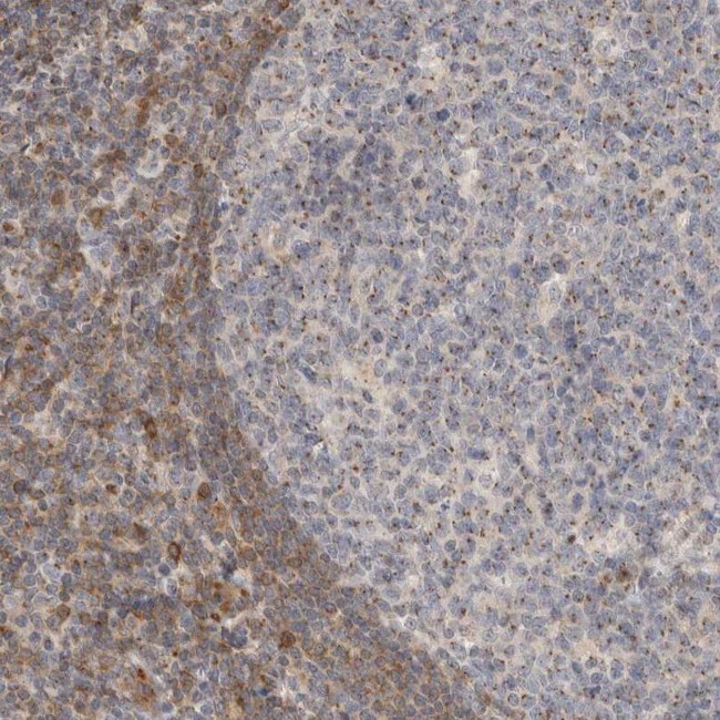 FAN Antibody in Immunohistochemistry (IHC)