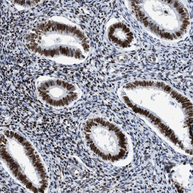 R3HCC1 Antibody in Immunohistochemistry (Paraffin) (IHC (P))