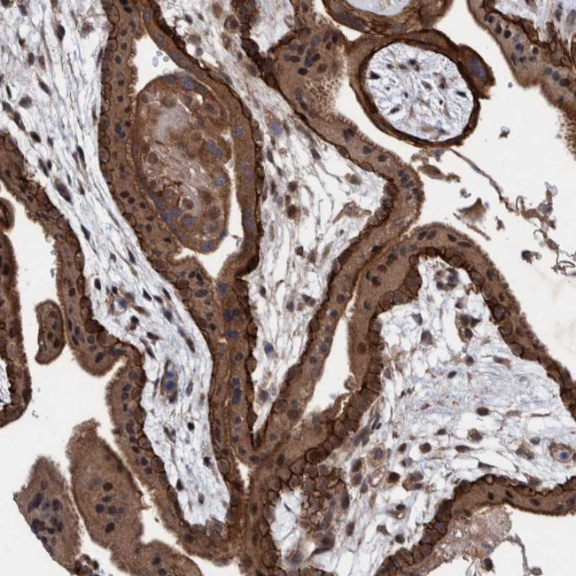 PIK3R6 Antibody in Immunohistochemistry (IHC)