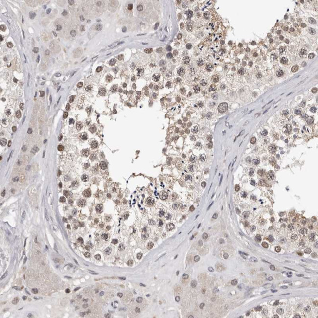 KIF2B Antibody in Immunohistochemistry (Paraffin) (IHC (P))