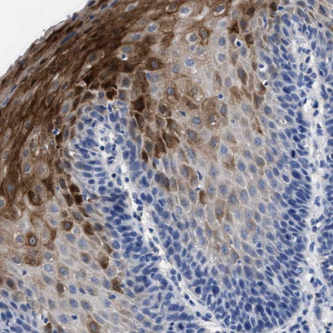 HID1 Antibody in Immunohistochemistry (Paraffin) (IHC (P))