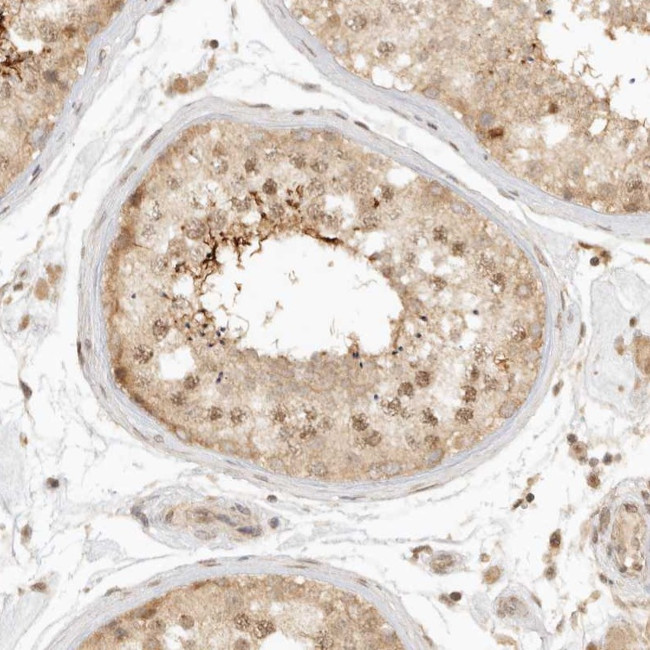 KIF2B Antibody in Immunohistochemistry (Paraffin) (IHC (P))