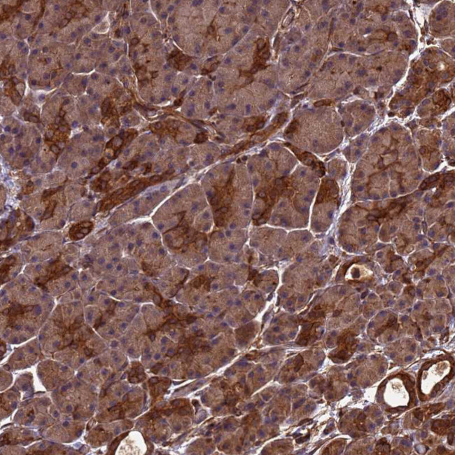ZNF618 Antibody in Immunohistochemistry (Paraffin) (IHC (P))