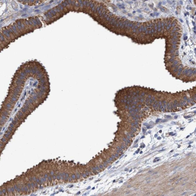 MRPL38 Antibody in Immunohistochemistry (IHC)