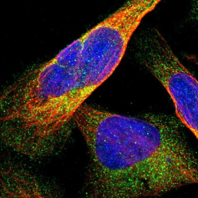 DDHD2 Antibody in Immunocytochemistry (ICC/IF)