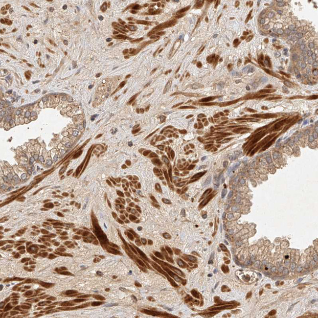 FAN Antibody in Immunohistochemistry (Paraffin) (IHC (P))