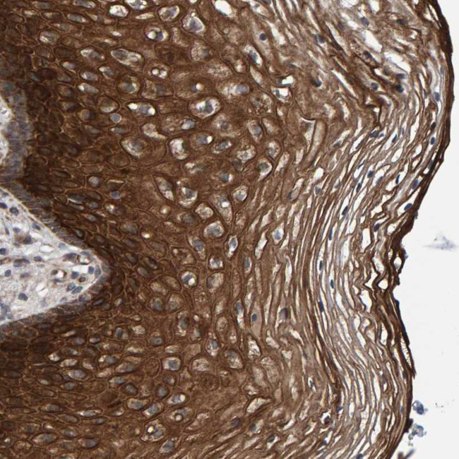 MFSD6L Antibody in Immunohistochemistry (Paraffin) (IHC (P))