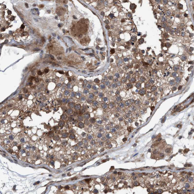 NISCH Antibody in Immunohistochemistry (Paraffin) (IHC (P))