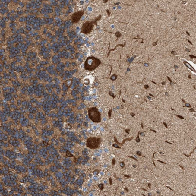 FMNL3 Antibody in Immunohistochemistry (Paraffin) (IHC (P))