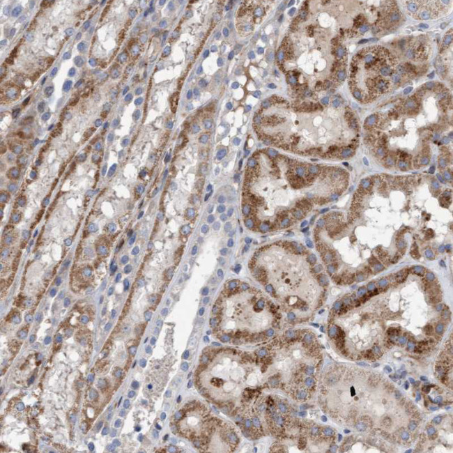 POLG2 Antibody in Immunohistochemistry (IHC)