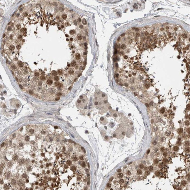 ZNF341 Antibody in Immunohistochemistry (IHC)