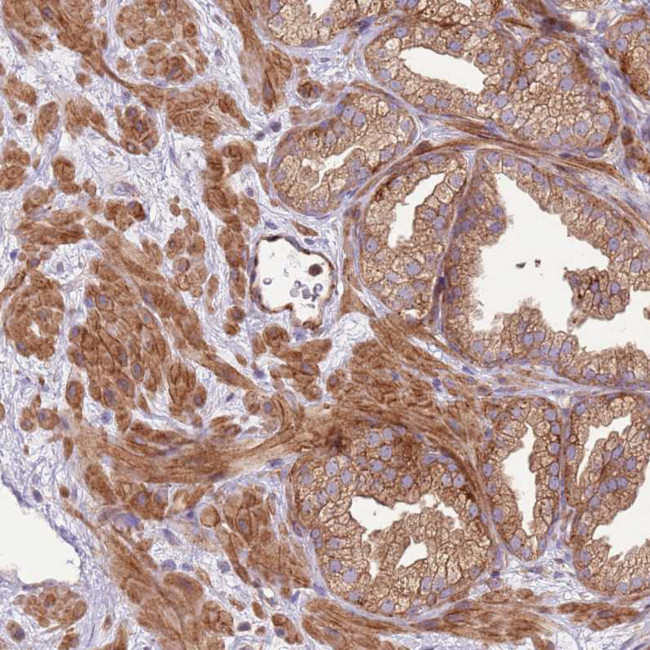 ZNF624 Antibody in Immunohistochemistry (Paraffin) (IHC (P))