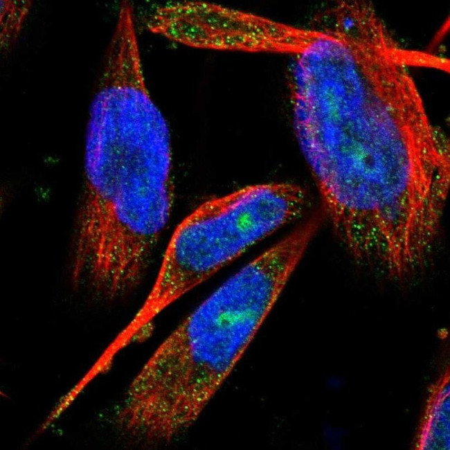 C17orf25 Antibody in Immunocytochemistry (ICC/IF)