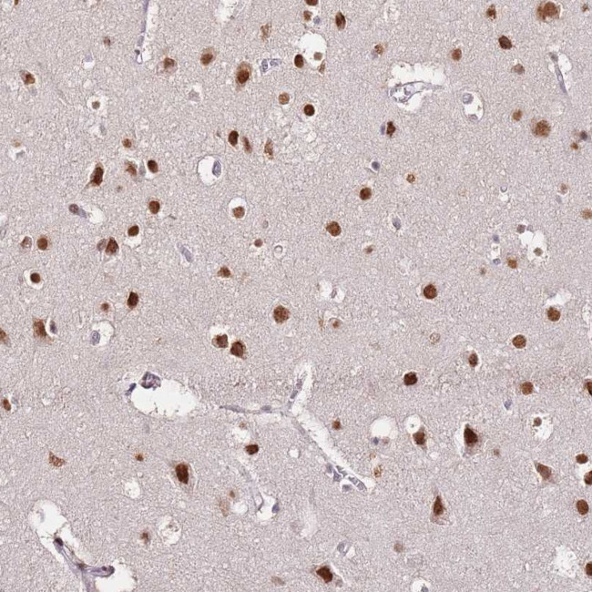 RFK Antibody in Immunohistochemistry (Paraffin) (IHC (P))