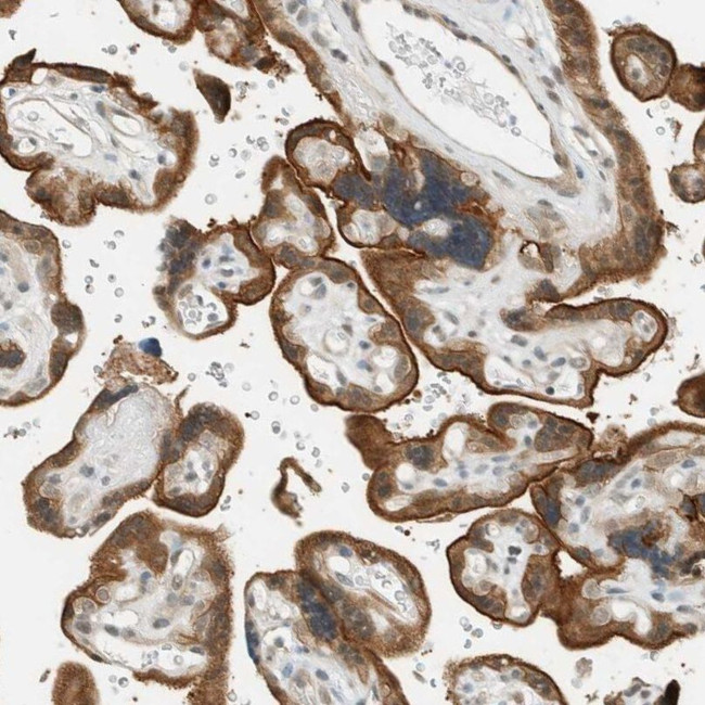 Niban-like protein Antibody in Immunohistochemistry (IHC)