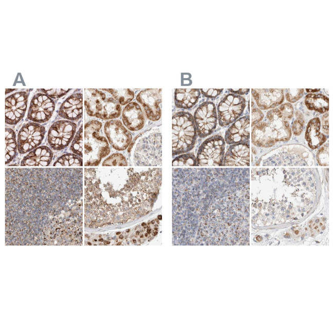 RNMTL1 Antibody in Immunohistochemistry (IHC)