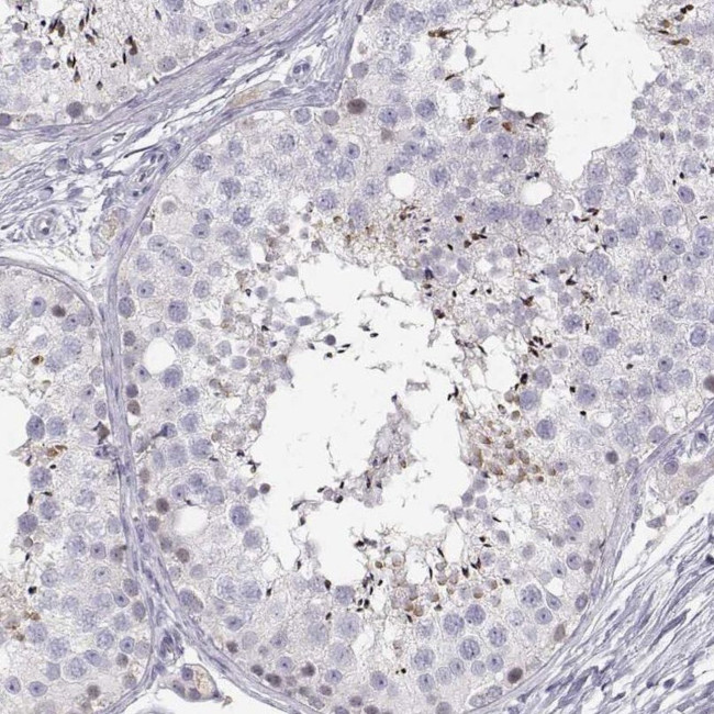 FAM166A Antibody in Immunohistochemistry (IHC)