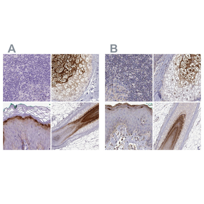 GSDMA Antibody in Immunohistochemistry (IHC)