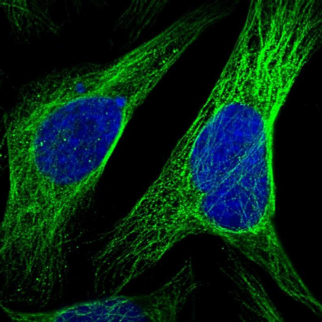 CCDC57 Antibody in Immunocytochemistry (ICC/IF)