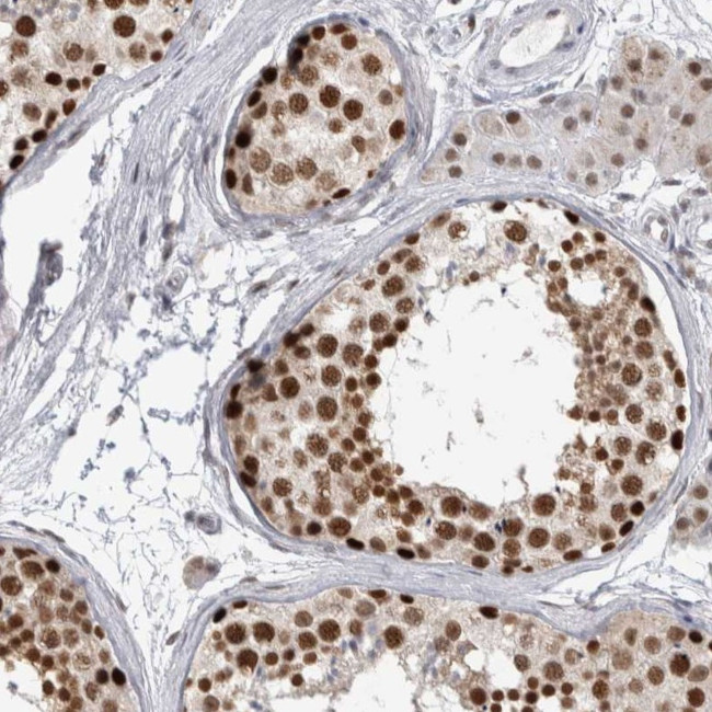 HEXIM2 Antibody in Immunohistochemistry (Paraffin) (IHC (P))