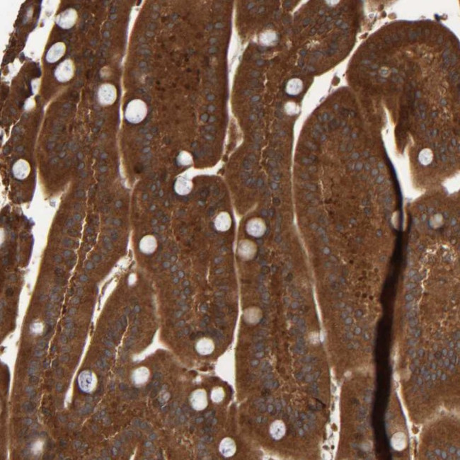 CCDC57 Antibody in Immunohistochemistry (Paraffin) (IHC (P))