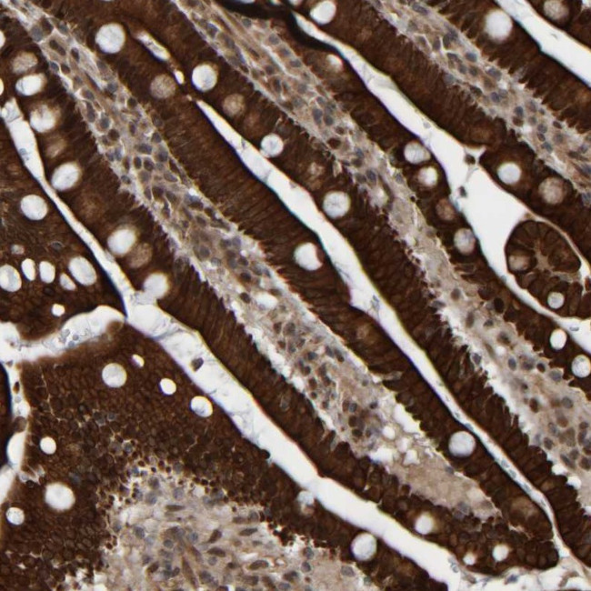 CCDC57 Antibody in Immunohistochemistry (Paraffin) (IHC (P))