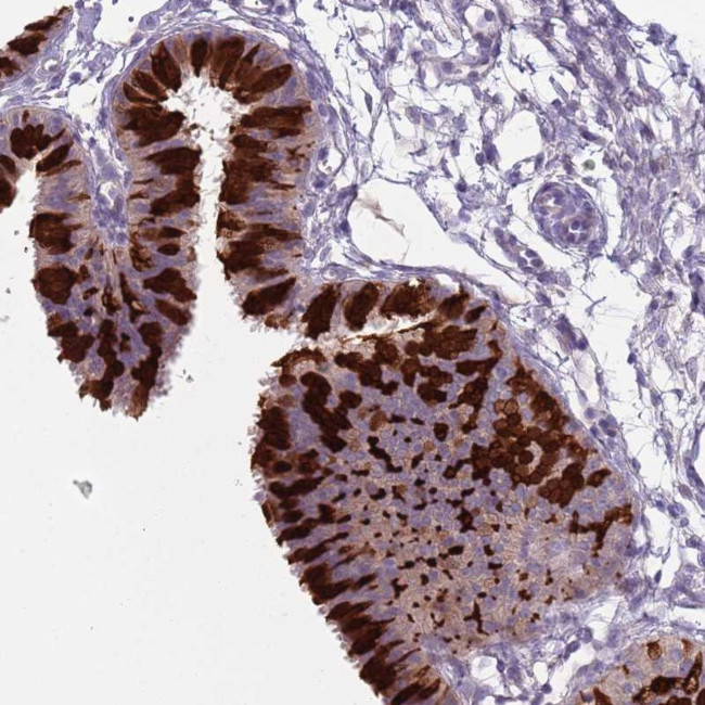 ZFP2 Antibody in Immunohistochemistry (Paraffin) (IHC (P))
