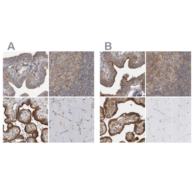 LRRC45 Antibody in Immunohistochemistry (IHC)