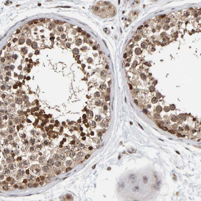 CCDC182 Antibody in Immunohistochemistry (Paraffin) (IHC (P))