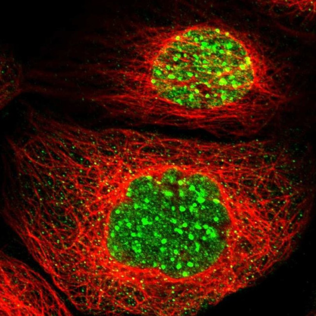 ATF7IP Antibody in Immunocytochemistry (ICC/IF)