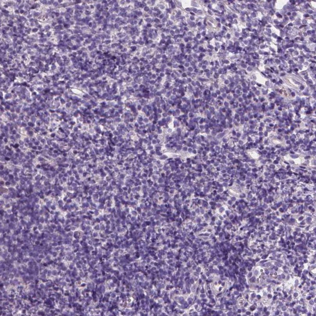 EFCAB1 Antibody in Immunohistochemistry (IHC)
