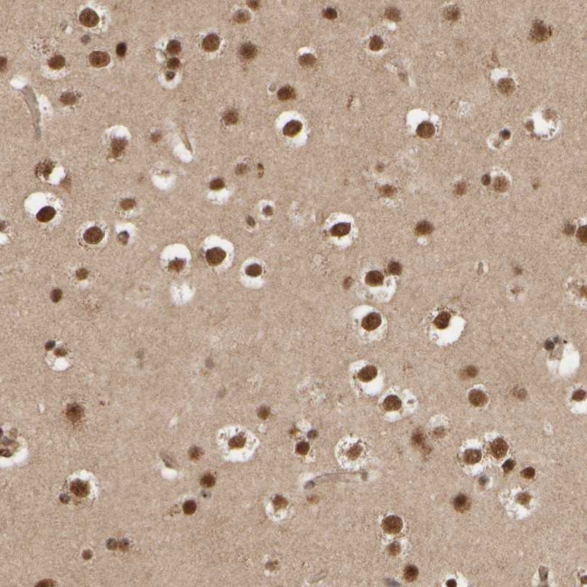 SYNRG Antibody in Immunohistochemistry (Paraffin) (IHC (P))