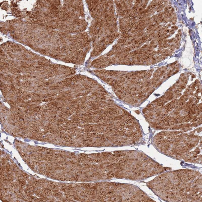 PHF21A Antibody in Immunohistochemistry (Paraffin) (IHC (P))