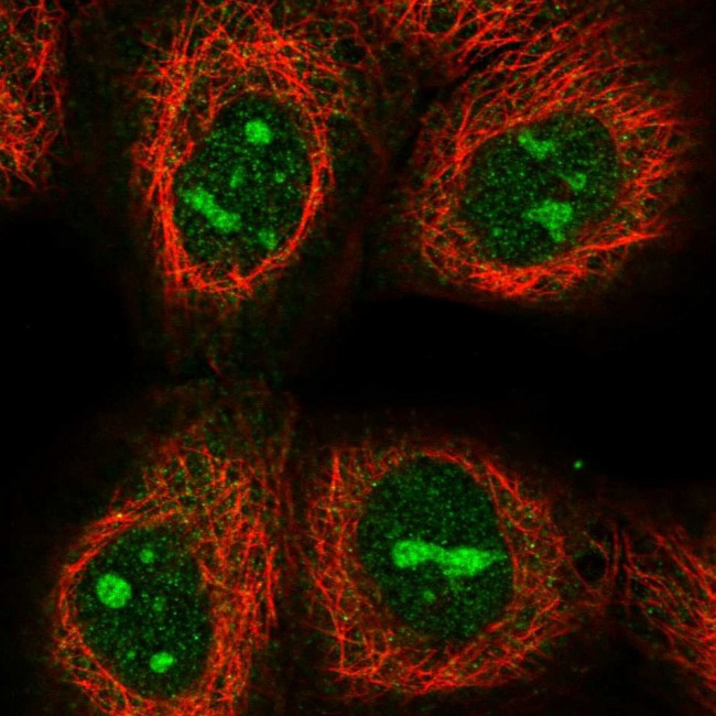 C17orf97 Antibody in Immunocytochemistry (ICC/IF)