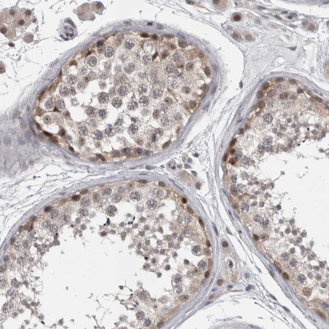 ZNF38 Antibody in Immunohistochemistry (Paraffin) (IHC (P))