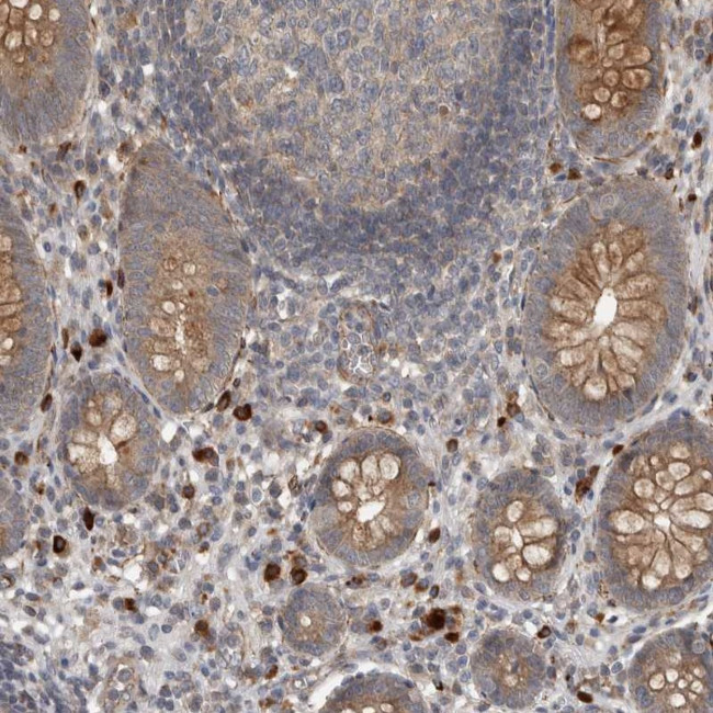 C11orf48 Antibody in Immunohistochemistry (Paraffin) (IHC (P))
