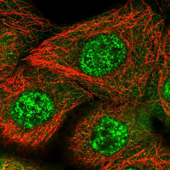 ZNF160 Antibody in Immunocytochemistry (ICC/IF)