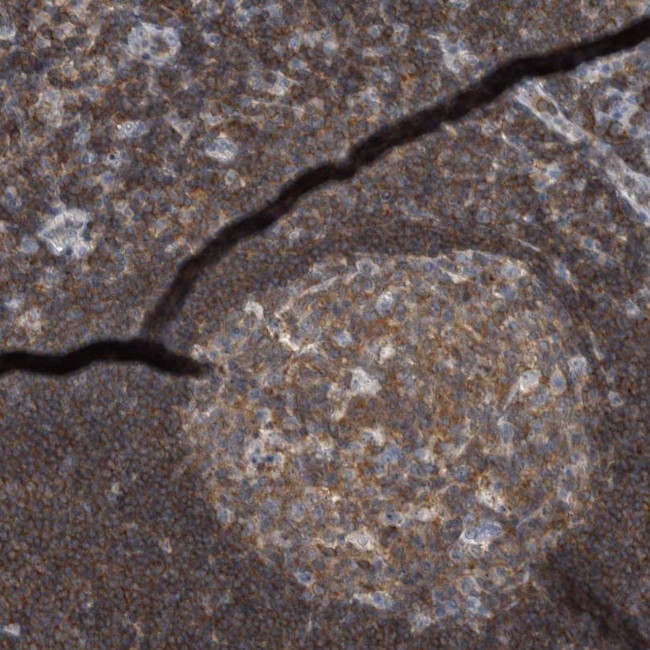 KIAA1731NL Antibody in Immunohistochemistry (Paraffin) (IHC (P))