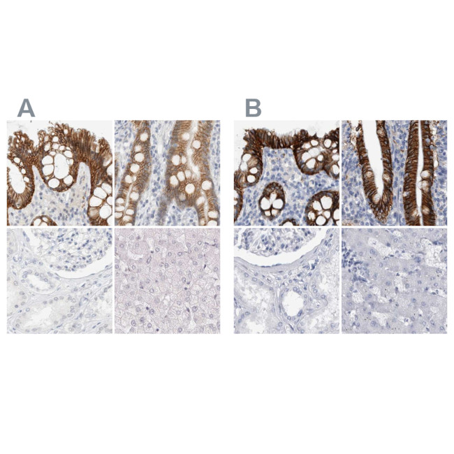 CDH17 Antibody in Immunohistochemistry (IHC)