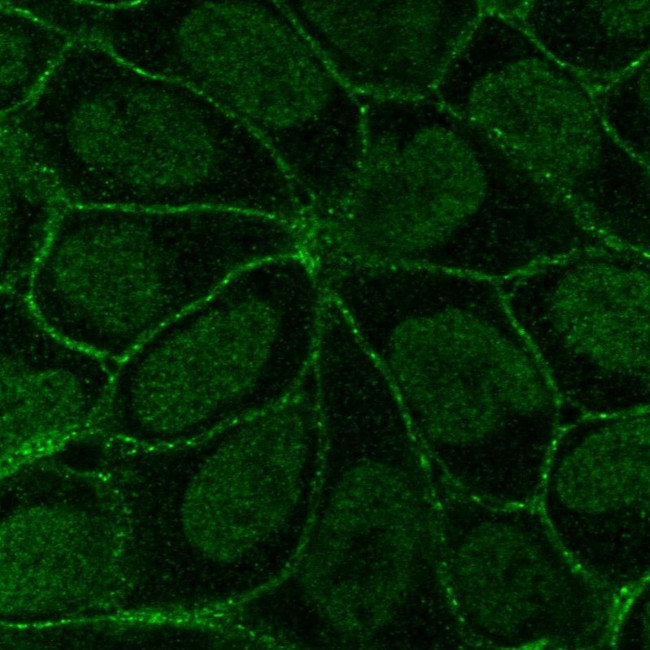 ITGB6 Antibody in Immunocytochemistry (ICC/IF)