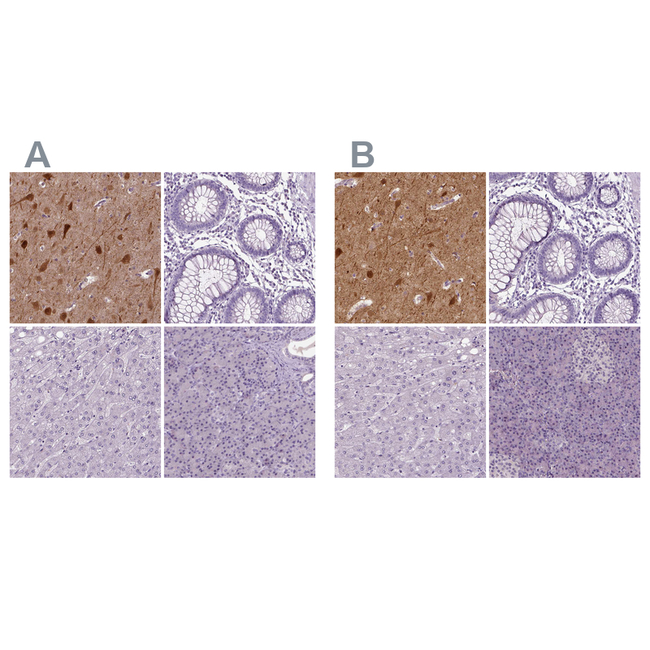 NECAB1 Antibody in Immunohistochemistry (Paraffin) (IHC (P))