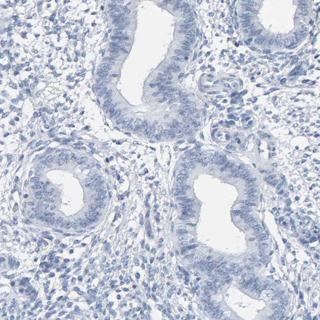 SPACA3 Antibody in Immunohistochemistry (Paraffin) (IHC (P))