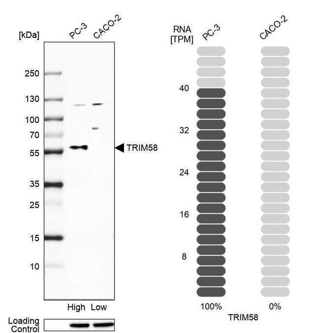 TRIM58 Antibody in Western Blot (WB)