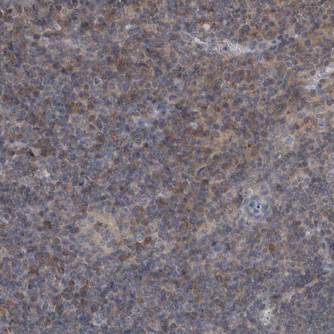 PROSC Antibody in Immunohistochemistry (IHC)
